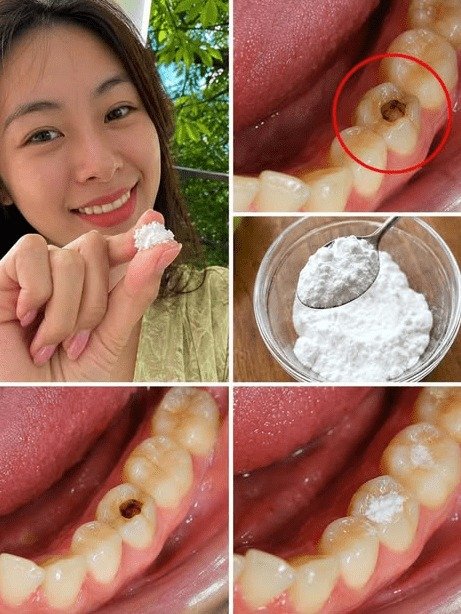 STOP! Are These 7 Tiny Tooth Warnings Silently Destroying Your Smile and Costing You a Fortune?