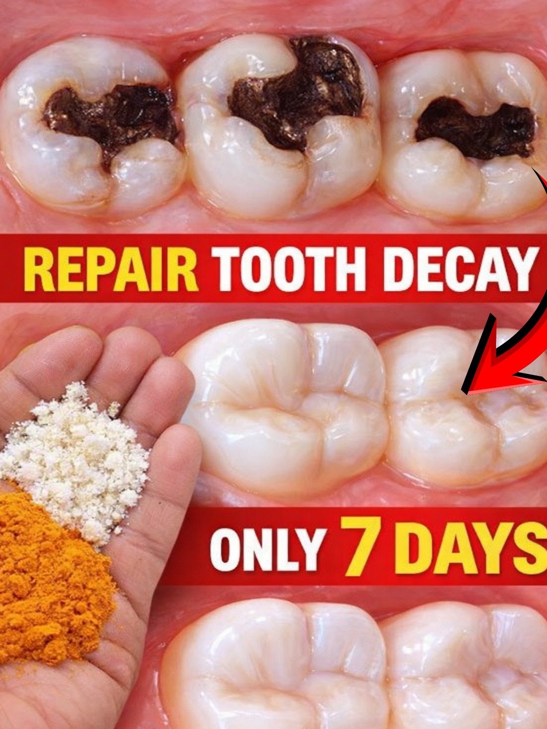 The 10-Minute Kitchen Secret That STOPS Tooth Pain, Erases Yellow Stains, and Fights Cavities!