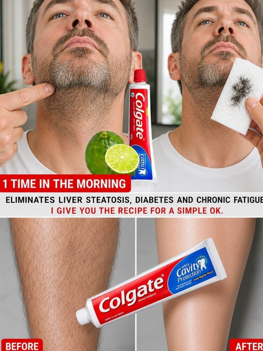The Viral Hair-Removal Paste: What 99% of Women Over 50 Don't Know (Before It's Too Late!)