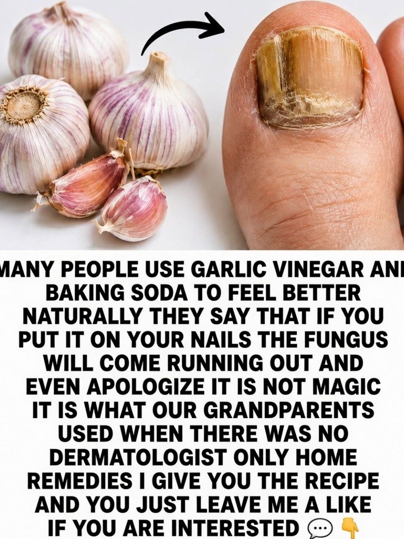 The Shocking Truth About 'Natural' Fungal Cures: What REALLY Works (And What Could Be Harming You!)