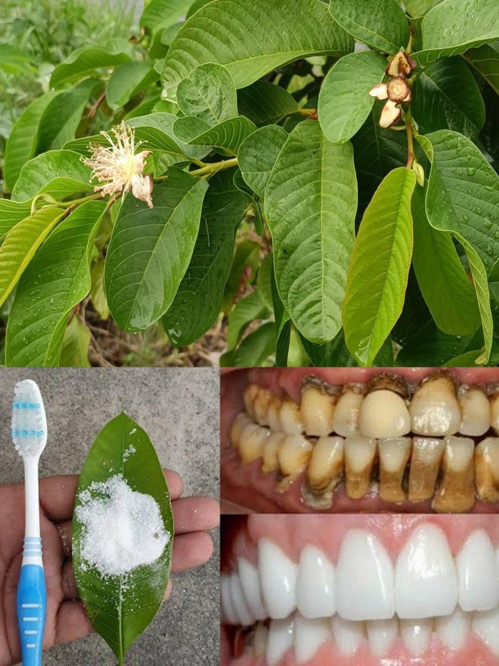 The Ancient Secret Your Dentist WON'T Tell You: 3 Guava Leaf Hacks for a Jaw-Dropping Smile!