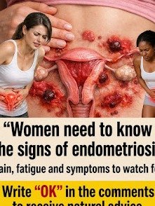 Is Your Period Pain *More* Than Just Cramps? The Urgent Guide to Endometriosis Every Woman Needs to See Now