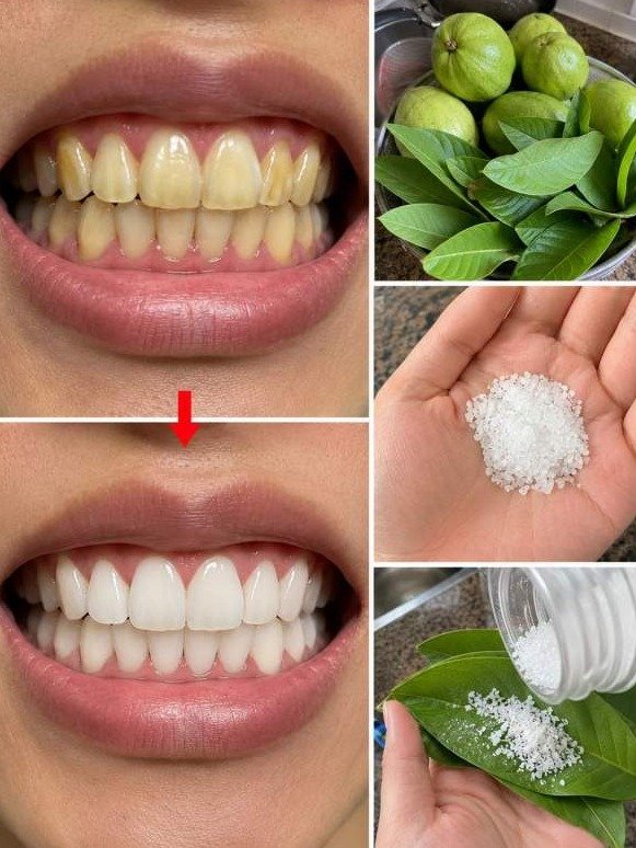 Unlock a Sparkling Mouth FAST: The Ancient Leaf Secret Dentists Are Silent About!