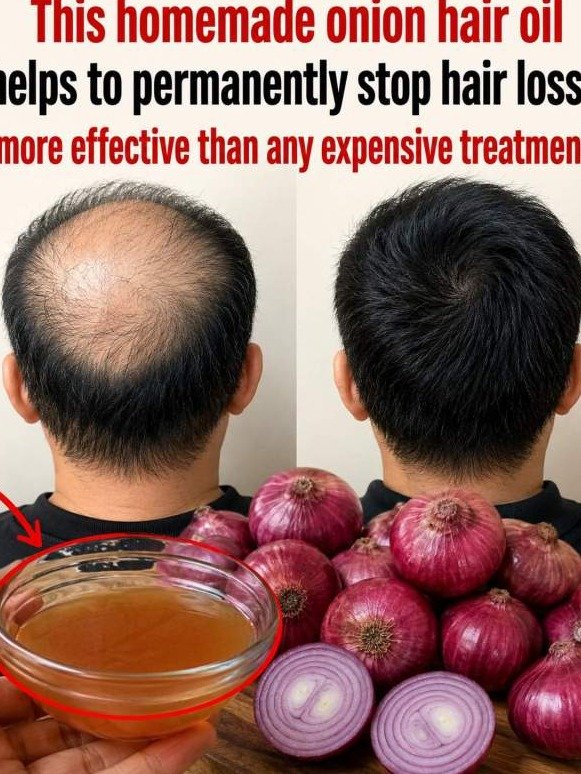 The SHOCKING Kitchen Secret That REVERSES Hair Loss & Wakes Up Dormant Follicles – Don't Miss Out!