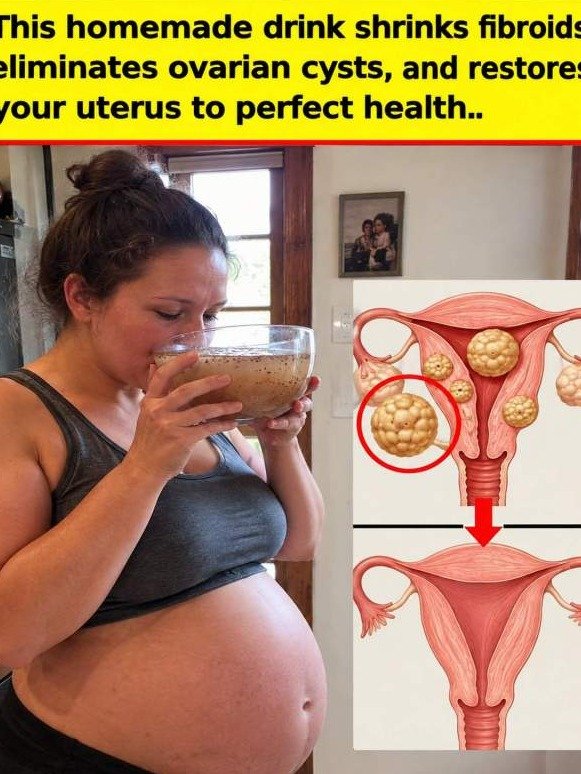 The 2-Ingredient “Uterus Reset”: Is This Simple Homemade Drink the Secret to Ending Pelvic Pressure?