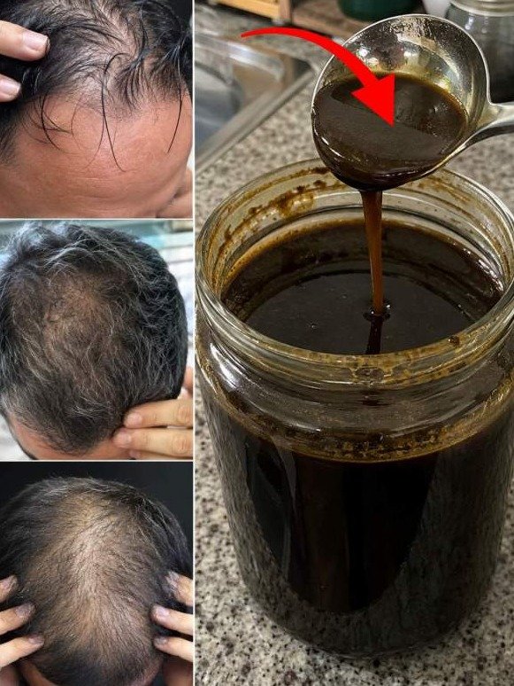 Your Hair Follicles Are ASLEEP! This 5-Ingredient Red Onion 'Scalp Flush' Will Shock Them Awake!