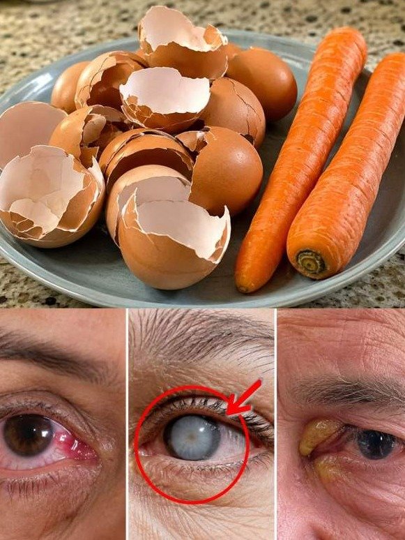 The Viral Carrot & Eggshell 'Eye Fix': What Everyone Gets WRONG (And What Your Vision REALLY Needs)