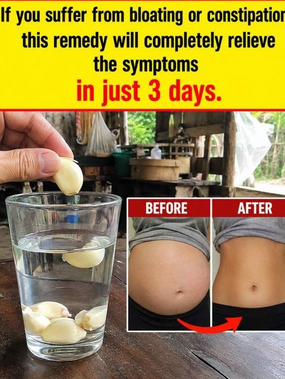 This Cheap Kitchen Hack Melts Away Swollen, Heavy Legs Overnight (Doctors Won't Tell You This)
