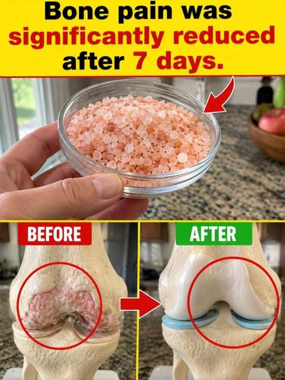 The ONE Mineral Switch That ERASES Bone Pain: Why You're Missing Out on Instant Relief!