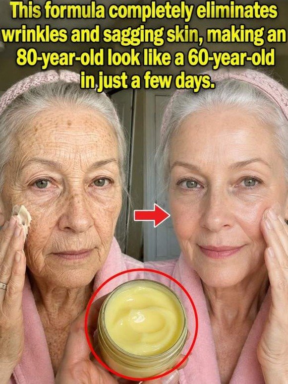 Forget Fillers! This 80-Year-Old Kitchen Mask Trick FORCES Wrinkled Skin To Look Fuller (You'll Regret Not Knowing This Sooner!)