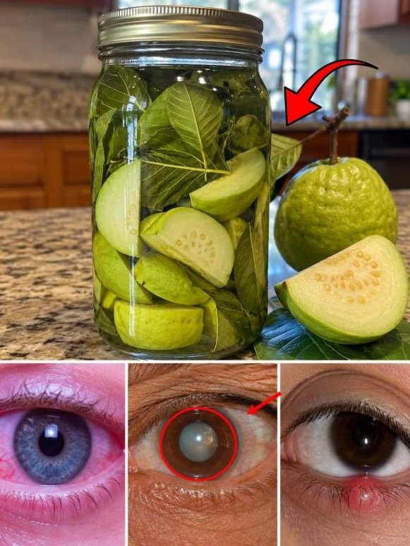 Unlock Your Eyes' Hidden Reset: Why Guava Leaves Are The Natural Fix You're Missing Out On!