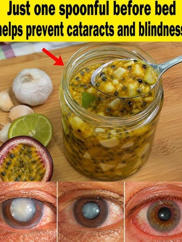 The Ignored Secret: Just One Spoon of THIS Mix Could Silence Your Gut Pain, Bloating, and Cecitis