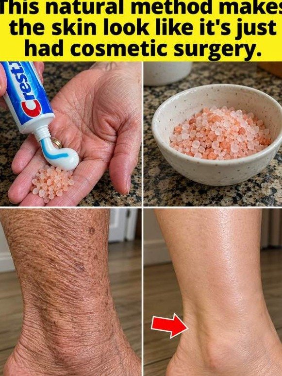 The 3-Ingredient Secret That Erases YEARS From Your Hands & Arms (Dermatologists Are Speechless!)