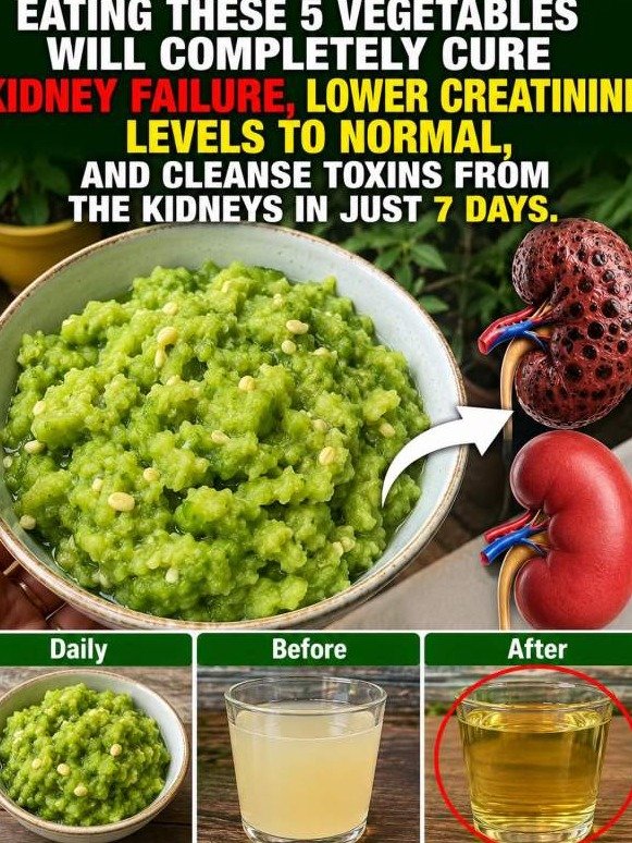 Stop Ignoring Your Kidneys: The 5 Kitchen Staples That Act Like a 'Biological Flush'