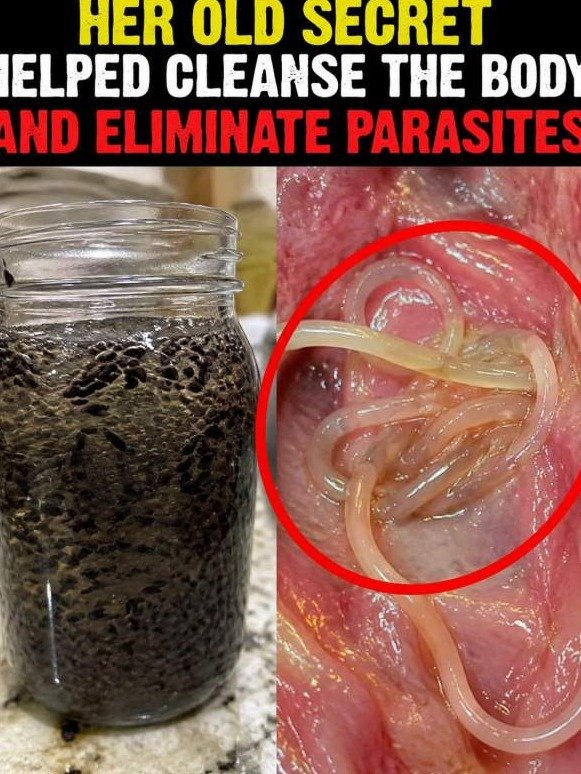 The Ancient 9-Ingredient Secret Your Gut NEEDS: How It Triggers a Brutal Parasite Flush