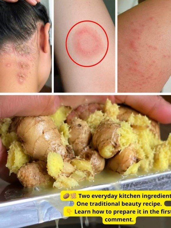 Forget Expensive Serums: This 2-Ingredient Kitchen Duo Will SHOCK Your Dull, Angry Skin Back to Life!