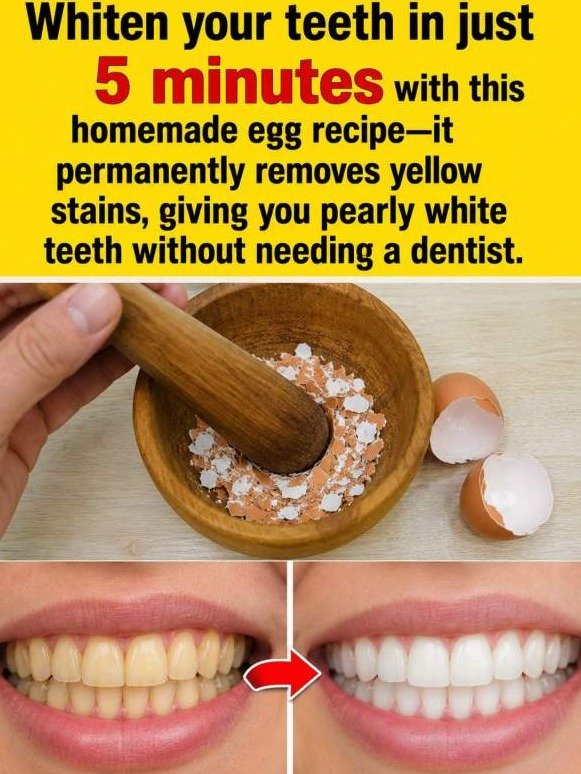 The Secret Weapon for Yellow Teeth? This Unlikely Kitchen Waste Unlocks a Dazzling Polish (You'll Wish You Knew Sooner!)