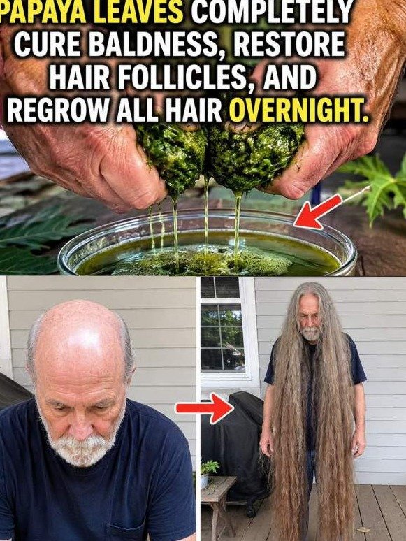 Why Your Scalp is 'Collapsing'—And How Papaya Leaf Wakes Up Dormant Follicles