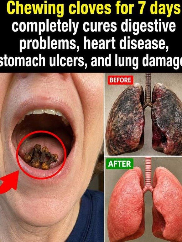 I Chewed Cloves for 7 Days and My Lungs and Gut Were Never the Same — Here's What Happened