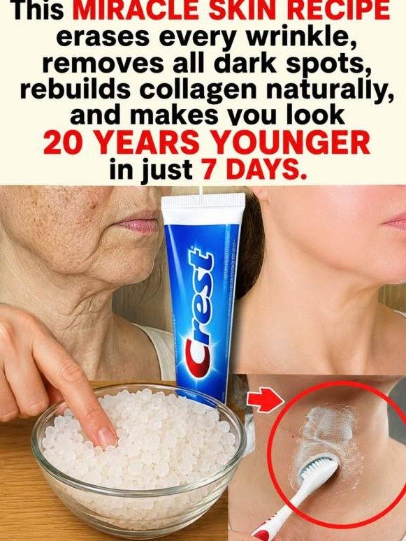 The Viral Toothpaste Hack For Dark Spots: The Shocking Truth You NEED To Know Before You Try It!