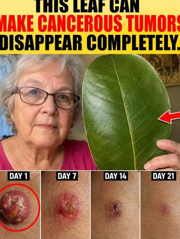 The Secret Leaf That Forces Tumors to Self-Destruct (Doctors Won't Tell You This)
