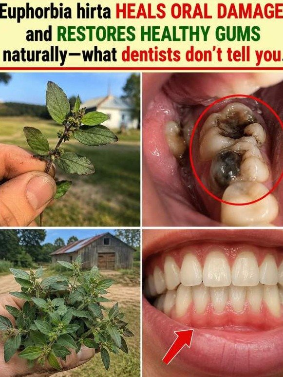 Is This 'Weed' the Secret to Reversing Gum Damage? Why Your Morning Breath Is Trying to Tell You Something