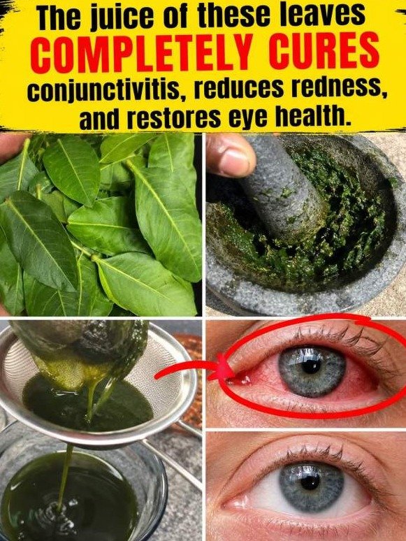 Stop Using 'Natural' Leaf Juice on Your Eyes: Why That Viral Remedy Is Actually Dangerous