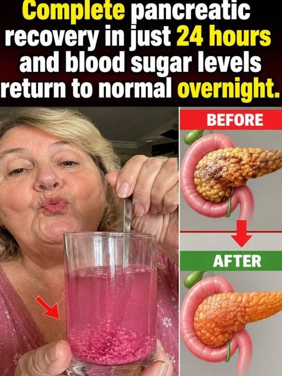 Your Pancreas Is Being Destroyed at 3 A.M. — Here's Why Your Morning Blood Sugar Is a Lie