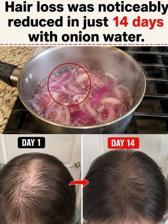 The Shocking Kitchen Secret That's REVERSING Hair Loss: Why Doctors Won't Tell You About Onion Water