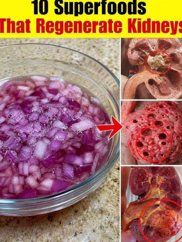 The #1 Kitchen Secret Your Kidneys Are Begging You To Know (And You're Already Buying It!)