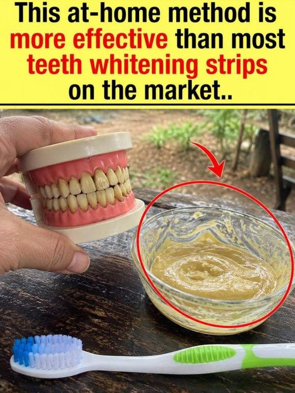 The $2 Kitchen Hack That's Stripping Years of Yellow Stains Off Teeth — Dentists Won't Tell You This