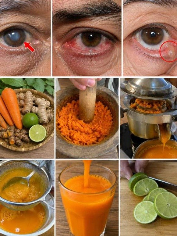 Don't Let Your Vision Fade! This Daily Juice Is Your Secret Weapon Against Dry Eyes, Cataracts, and Macular Degeneration