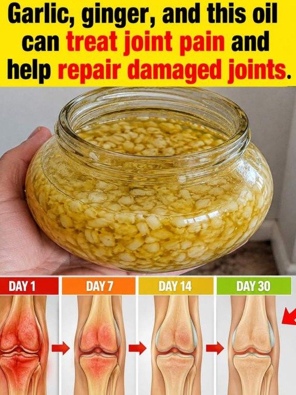 The #1 Kitchen Secret: How Garlic & Ginger Force a 'Joint Drainage Surge' You Can't Afford to Miss!