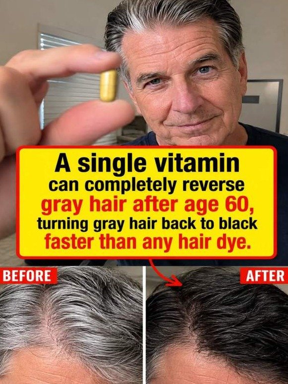 The Secret Vitamin That Could Turn Back the Clock on Your Gray Hair