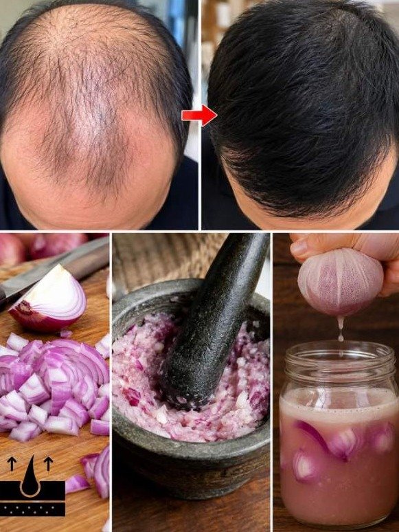 The Unbelievable Kitchen Secret That Wakes Up Dormant Hair Roots and REVERSES Thinning Hair (Don't Miss Out!)
