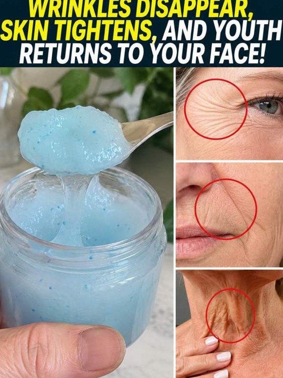 The Little-Known Blue Gel That *Forces* Your Mouth Wrinkles to Tighten (And Why Yours Haven't Faded Yet!)
