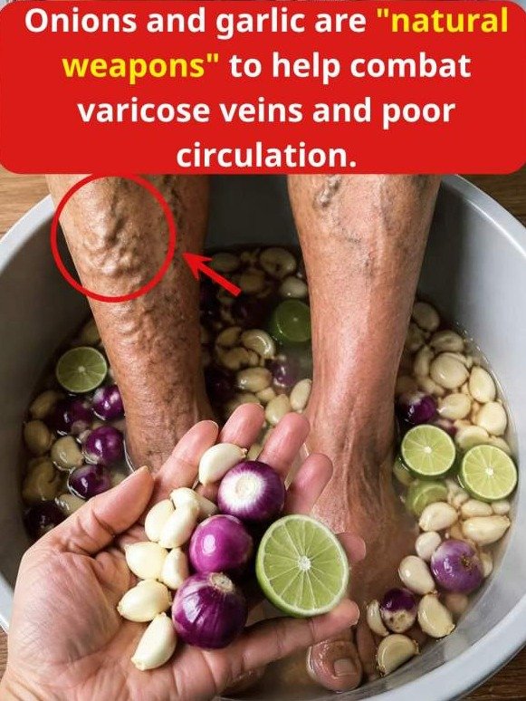 The ONE Kitchen Secret That FLUSHES Bulging Veins and Makes Heavy Legs Feel Brand New