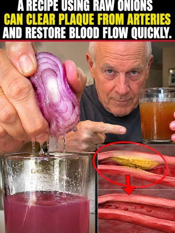 The Stupid-Simple Onion Hack That Unclogs Your Blood Flow Overnight (Doctors Won't Tell You)