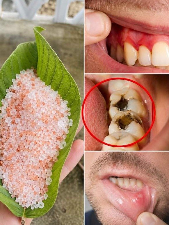 The Ignored Secret: This Humble Leaf Triggers a 'Brutal Mouth Reset' That Obliterates Cavities and Bad Breath!