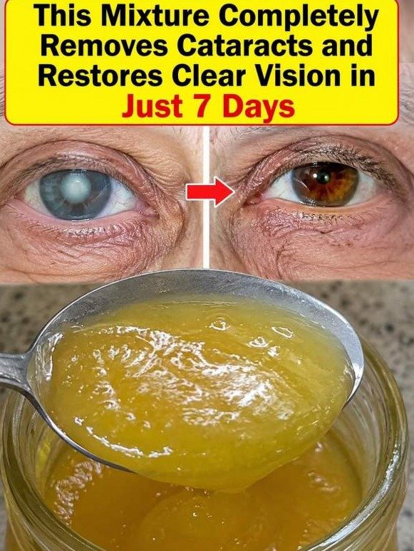 The 1-Spoon Secret Eye Doctors WON'T Tell You: Unlock Crystal-Clear Distance Vision!