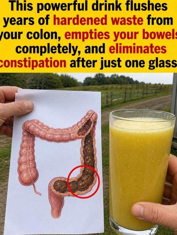 The Viral Yellow Drink That Forces YEARS of Hardened Waste Out of Your Colon (Works in Hours!)