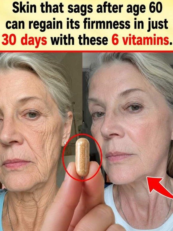 6 Vitamins That Tighten Sagging Skin After 60 — #3 Does the Heavy Lifting Most People Miss