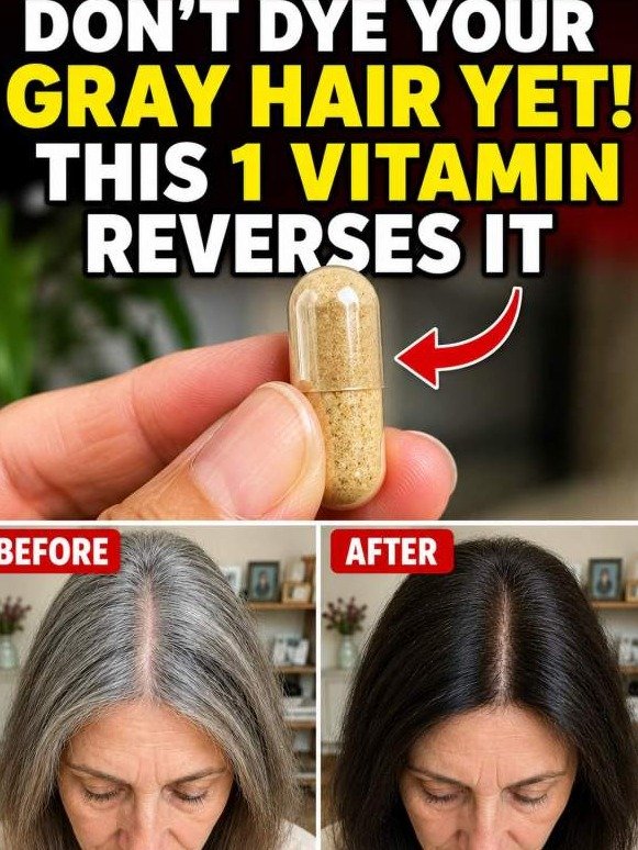 Stop Hiding Gray Hair! This Shocking B Vitamin Secret Recharges Follicles From Within (And It's NOT What You Think)