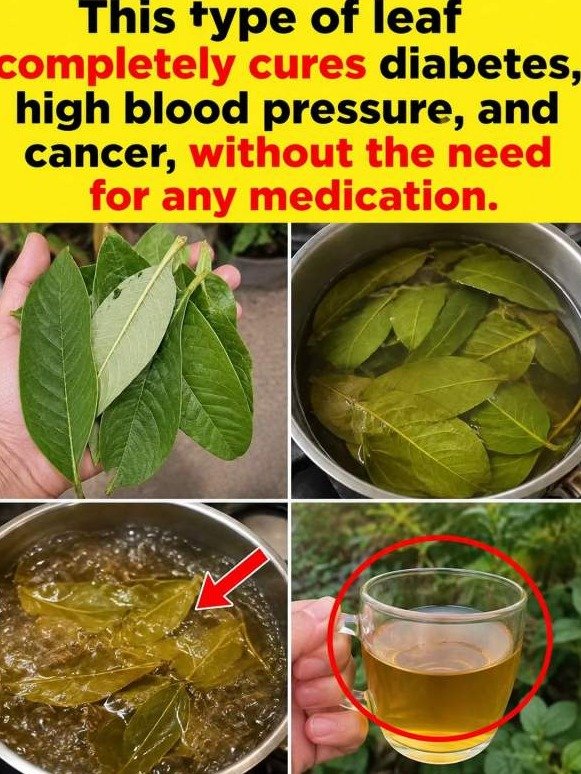 The Hidden Power of Guava Leaves: How They Force a Blood Sugar Reset Your Body Has Been Begging For