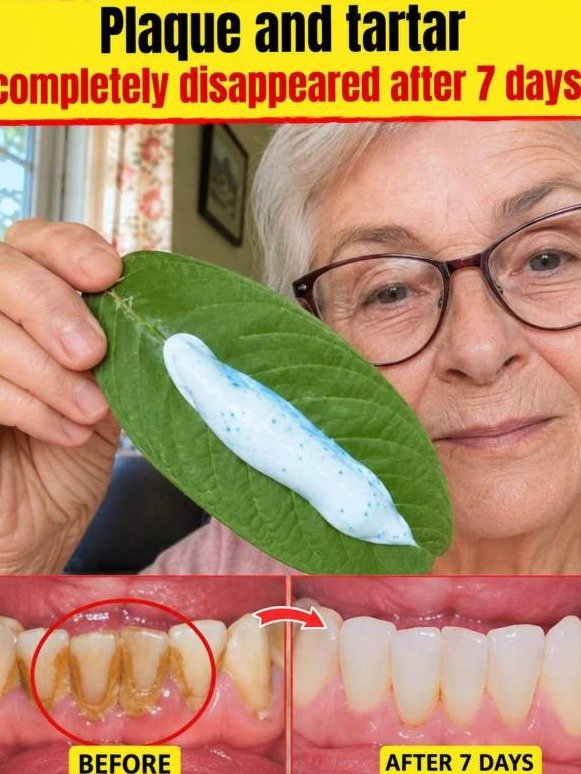 Guava Leaf: The Plaque-Ripping Oral Reset Nobody Is Talking About