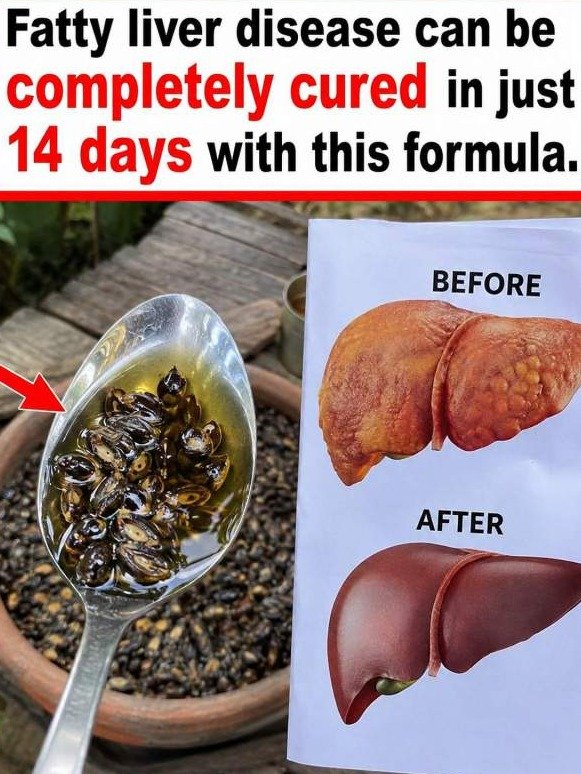 Stop Throwing Away the Only Part of Papaya That Actually Works: Seeds That Cleanse Your Liver & Gut