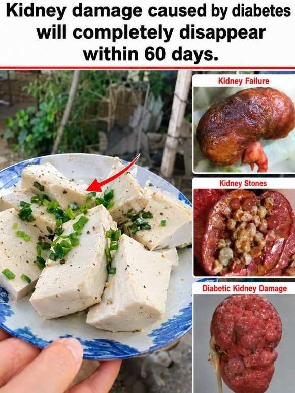 Diabetic Shock: The 'Harmless' White Food Secretly Wrecking Your Kidneys (You Eat It Every Day!)