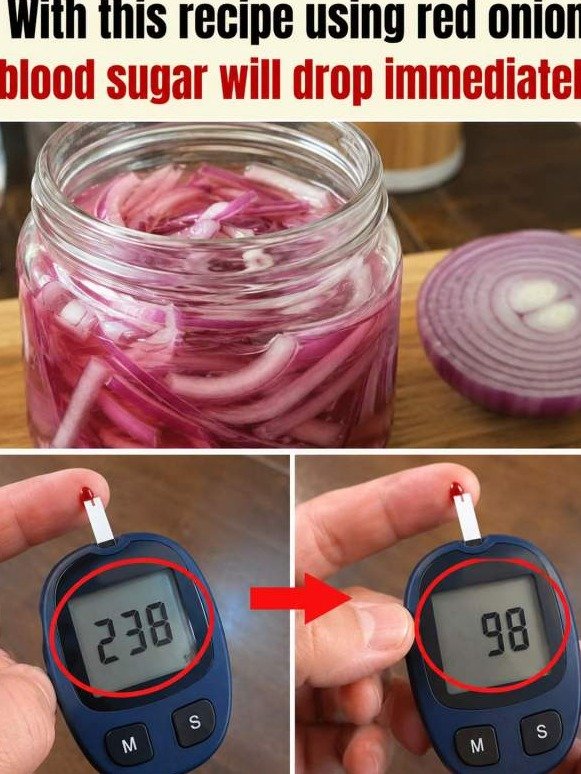 Shocking Truth: Red Onion Doesn't Just Taste Good, It REVERSES Blood Sugar Chaos (You Won't Believe What's in the Peel!)