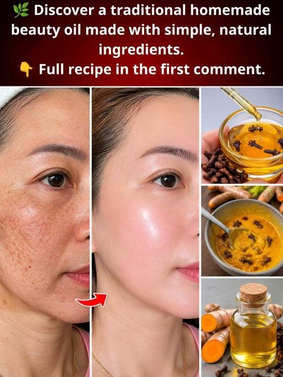 The *Hidden* $2 Clove Oil Trick That Will COMPLETELY Reset Your Skin Barrier (Big Beauty Hopes You NEVER Find Out)