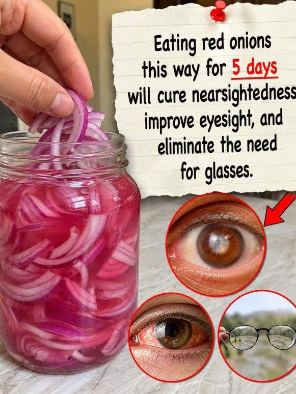 The Shocking Red Onion Secret That Could Transform Your Vision: Are You Missing Out?